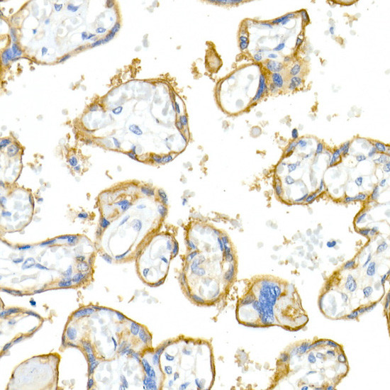 CD51 Antibody in Immunohistochemistry (Paraffin) (IHC (P))