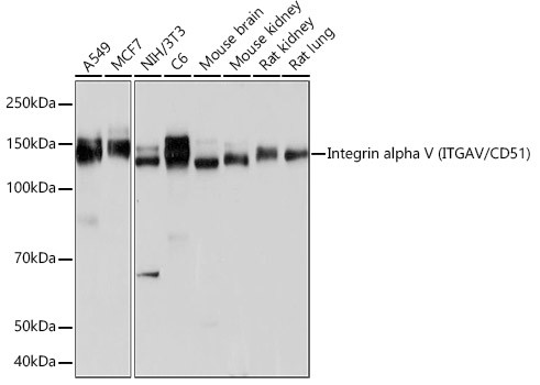 CD51 Antibody in Western Blot (WB)