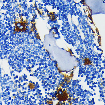 CD61 (Integrin beta 3) Antibody in Immunohistochemistry (Paraffin) (IHC (P))