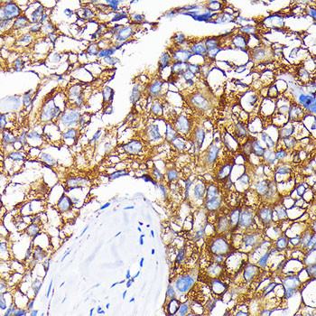 Leptin Receptor Antibody in Immunohistochemistry (Paraffin) (IHC (P))