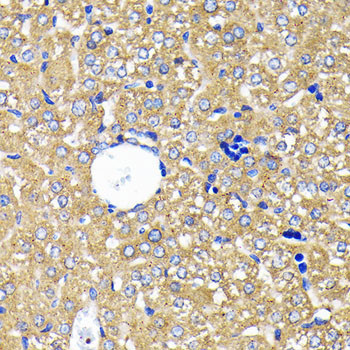 Leptin Receptor Antibody in Immunohistochemistry (Paraffin) (IHC (P))