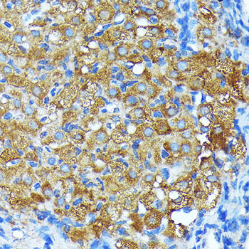 Leptin Receptor Antibody in Immunohistochemistry (Paraffin) (IHC (P))