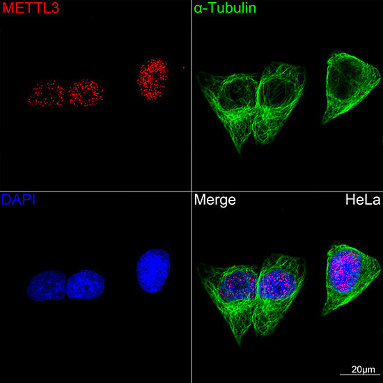 METTL3 Antibody in Immunocytochemistry (ICC/IF)