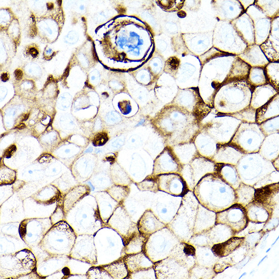 MUC1 Antibody in Immunohistochemistry (Paraffin) (IHC (P))