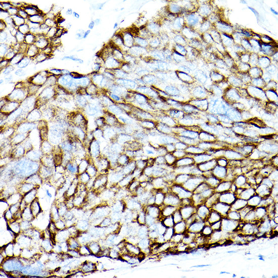 MUC1 Antibody in Immunohistochemistry (Paraffin) (IHC (P))