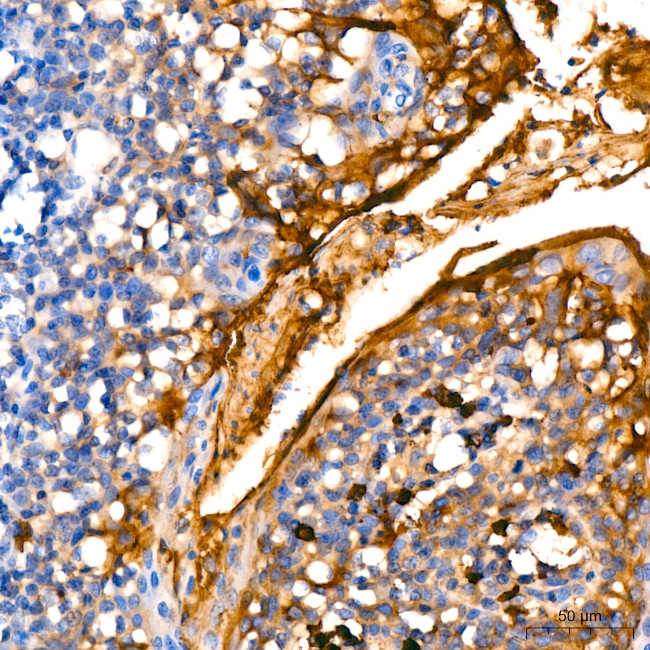 MUC1 Antibody in Immunohistochemistry (Paraffin) (IHC (P))