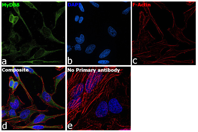 MyD88 Antibody in Immunocytochemistry (ICC/IF)