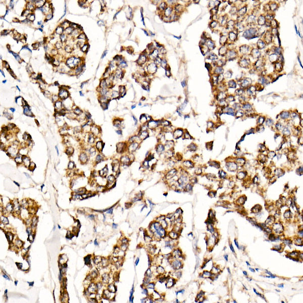 MyD88 Antibody in Immunohistochemistry (Paraffin) (IHC (P))