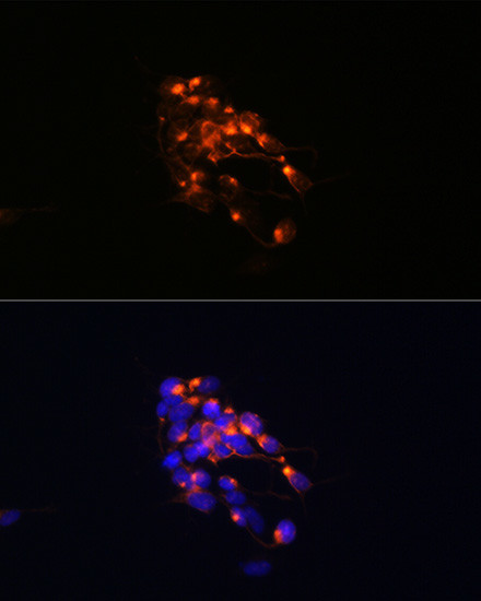 NEFM Antibody in Immunocytochemistry (ICC/IF)