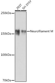 NEFM Antibody in Western Blot (WB)