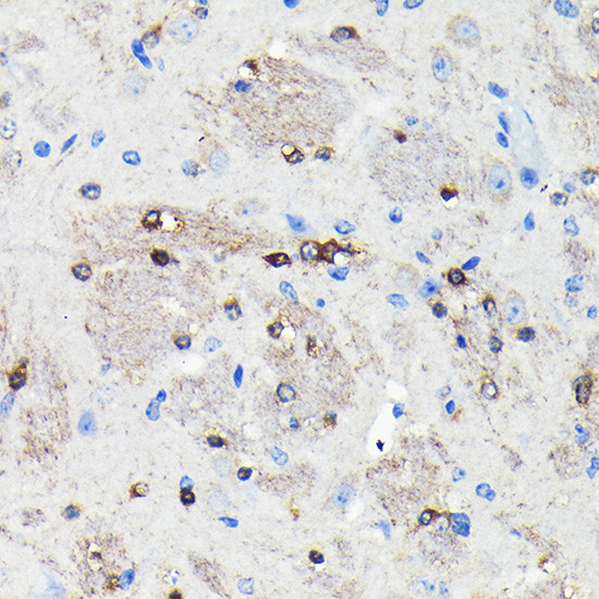 NMDAR2A Antibody in Immunohistochemistry (Paraffin) (IHC (P))