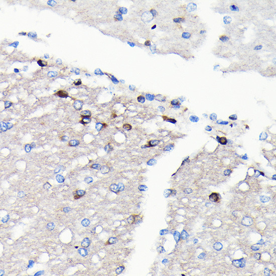 NMDAR2A Antibody in Immunohistochemistry (Paraffin) (IHC (P))