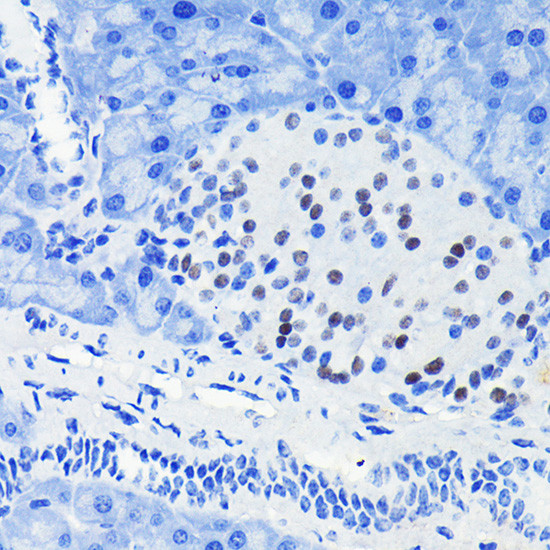 PAX6 Antibody in Immunohistochemistry (Paraffin) (IHC (P))