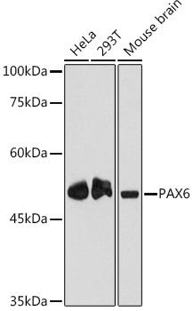 PAX6 Antibody in Western Blot (WB)