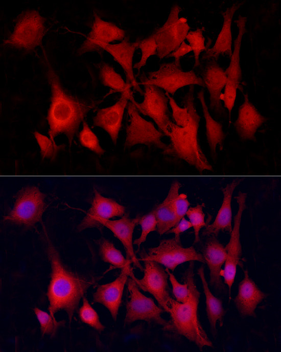 PGP9.5 Antibody in Immunocytochemistry (ICC/IF)