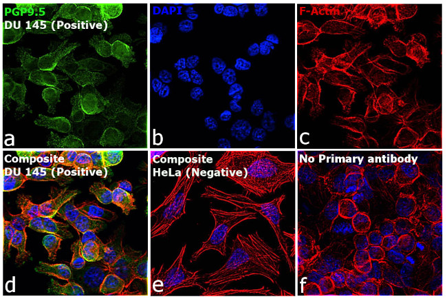 PGP9.5 Antibody in Immunocytochemistry (ICC/IF)