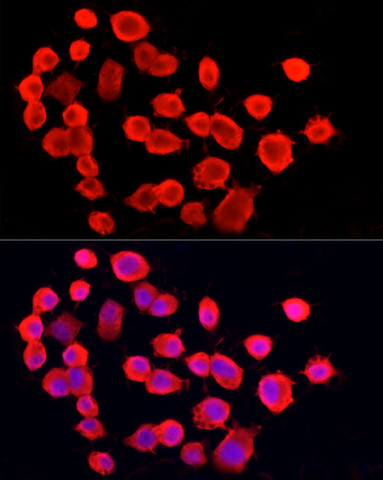 PGP9.5 Antibody in Immunocytochemistry (ICC/IF)