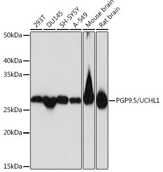 PGP9.5 Antibody in Western Blot (WB)