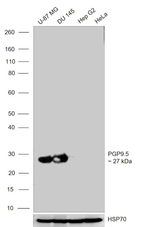 PGP9.5 Antibody in Western Blot (WB)