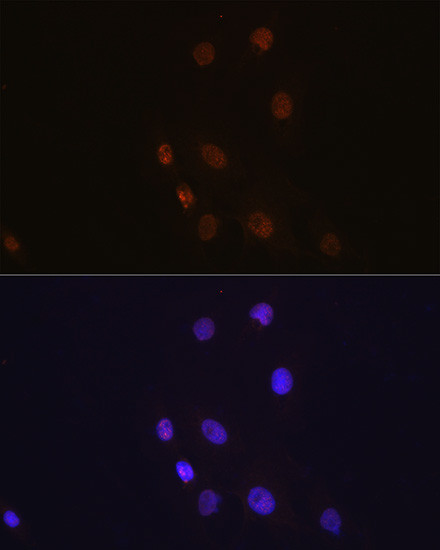 S100A4 Antibody in Immunocytochemistry (ICC/IF)