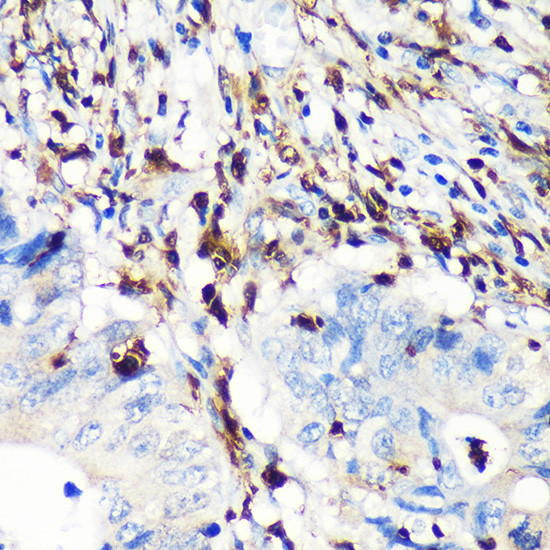 S100A4 Antibody in Immunohistochemistry (Paraffin) (IHC (P))