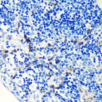 S100A4 Antibody in Immunohistochemistry (Paraffin) (IHC (P))