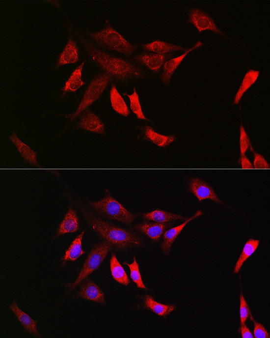 SHP2 Antibody in Immunocytochemistry (ICC/IF)