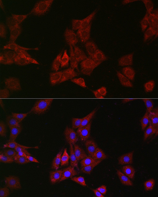 SHP2 Antibody in Immunocytochemistry (ICC/IF)