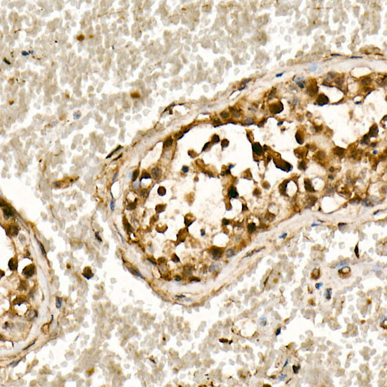 SMAD3 Antibody in Immunohistochemistry (Paraffin) (IHC (P))