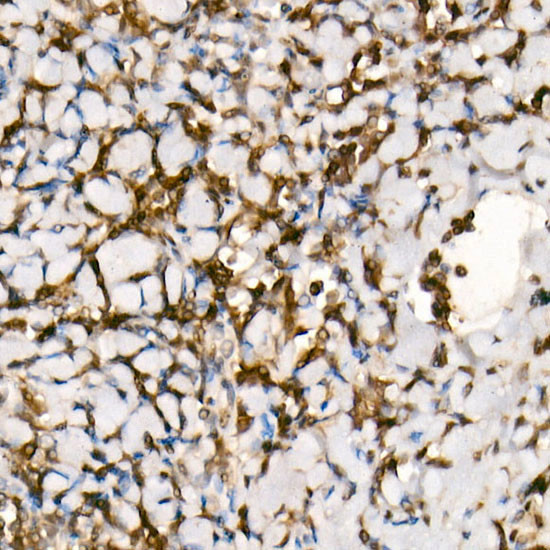 SMAD3 Antibody in Immunohistochemistry (Paraffin) (IHC (P))