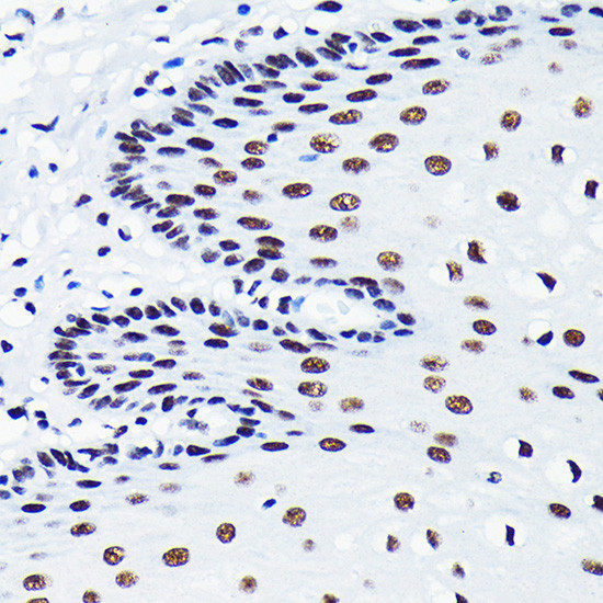 TDP-43 Antibody in Immunohistochemistry (Paraffin) (IHC (P))