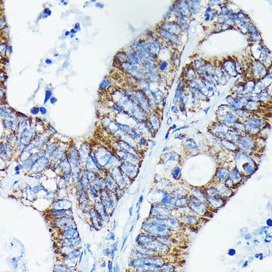 TNFAIP3 Antibody in Immunohistochemistry (Paraffin) (IHC (P))