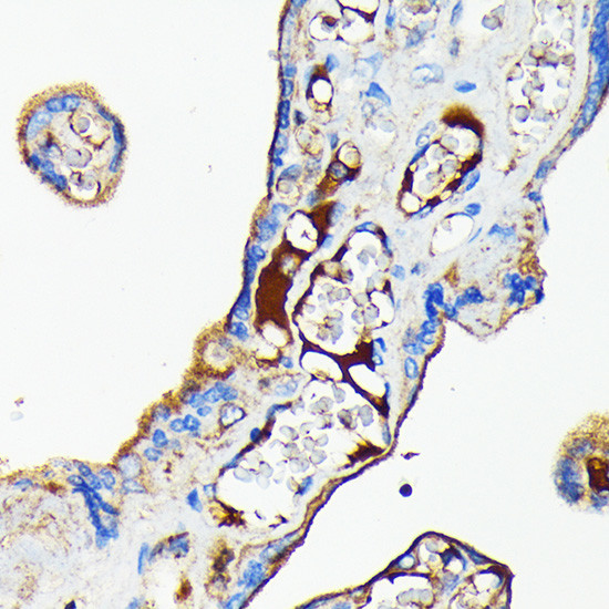 Transferrin Antibody in Immunohistochemistry (Paraffin) (IHC (P))