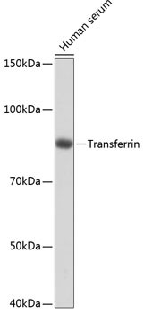 Transferrin Antibody in Western Blot (WB)