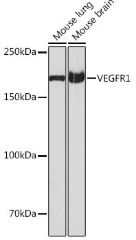 VEGF Receptor 1 Antibody in Western Blot (WB)