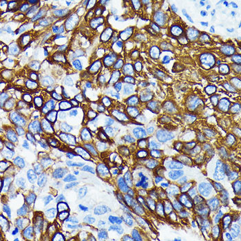 WNT5A Antibody in Immunohistochemistry (Paraffin) (IHC (P))