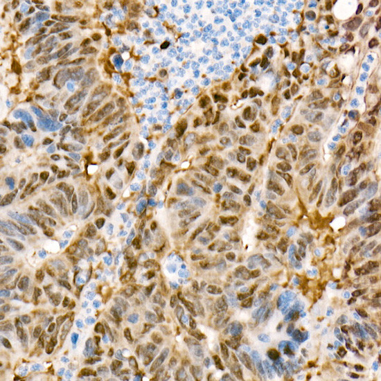 YAP1 Antibody in Immunohistochemistry (Paraffin) (IHC (P))