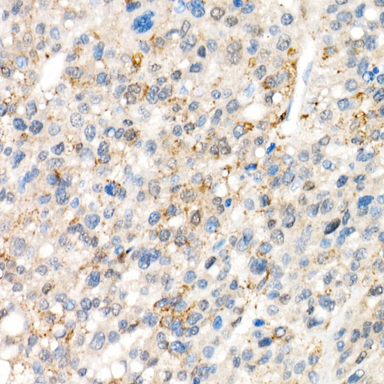 YAP1 Antibody in Immunohistochemistry (Paraffin) (IHC (P))