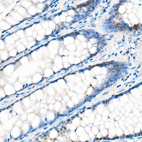 YAP1 Antibody in Immunohistochemistry (Paraffin) (IHC (P))