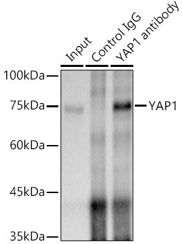 YAP1 Antibody in Immunoprecipitation (IP)