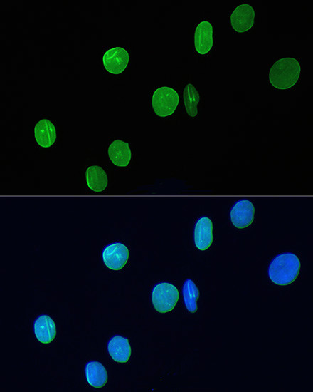 Lamin A/C Antibody in Immunocytochemistry (ICC/IF)