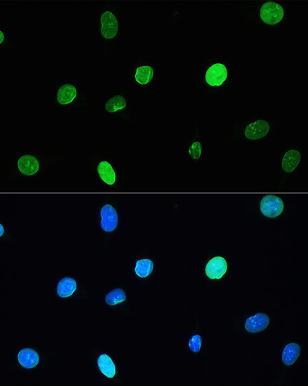 Lamin A/C Antibody in Immunocytochemistry (ICC/IF)