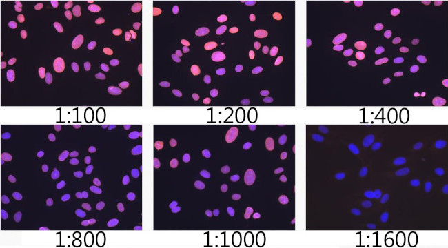 Lamin A/C Antibody in Immunocytochemistry (ICC/IF)