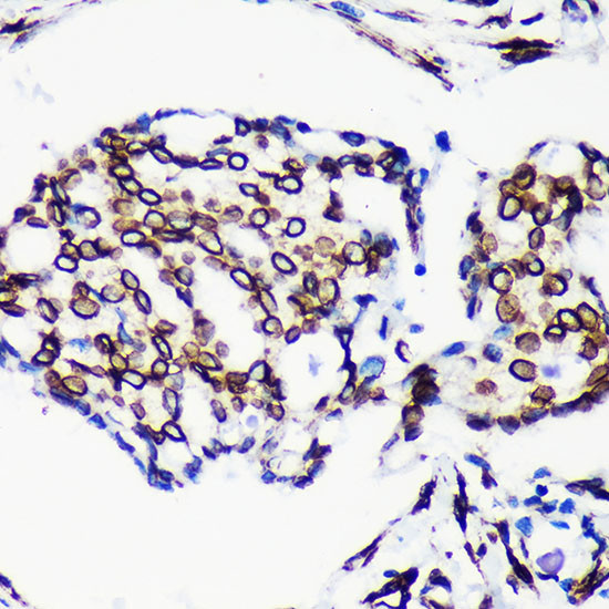 Lamin A/C Antibody in Immunohistochemistry (Paraffin) (IHC (P))