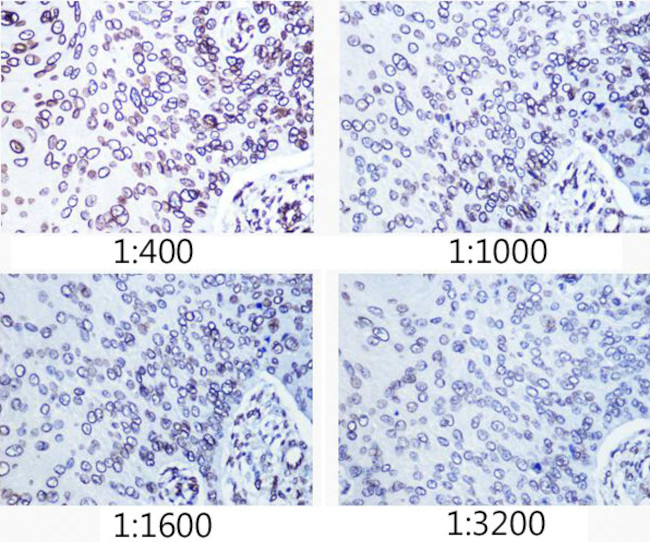 Lamin A/C Antibody in Immunohistochemistry (Paraffin) (IHC (P))