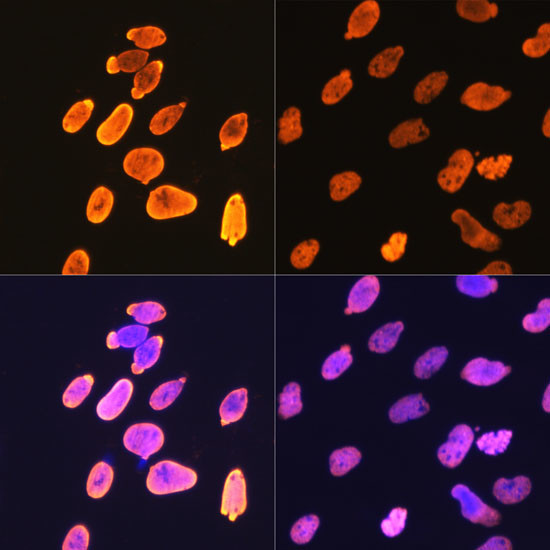 H4K5ac Antibody in Immunocytochemistry (ICC/IF)