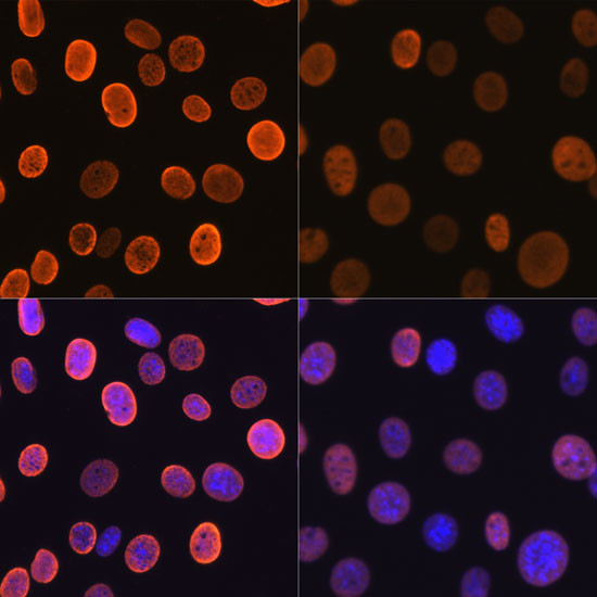 H4K5ac Antibody in Immunocytochemistry (ICC/IF)