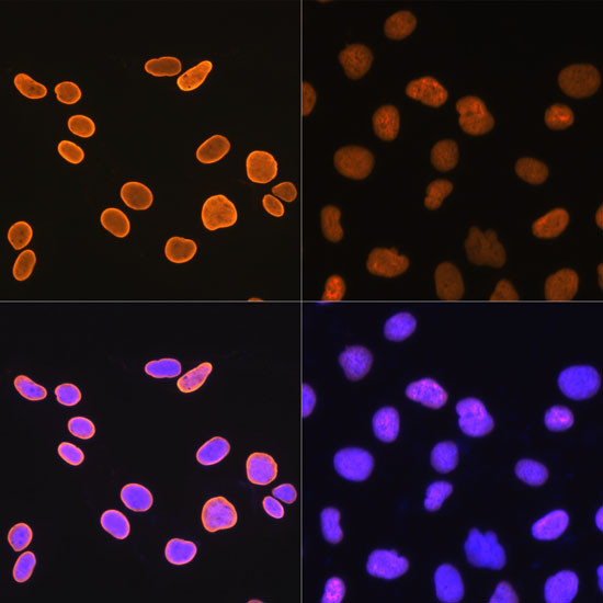 H4K5ac Antibody in Immunocytochemistry (ICC/IF)