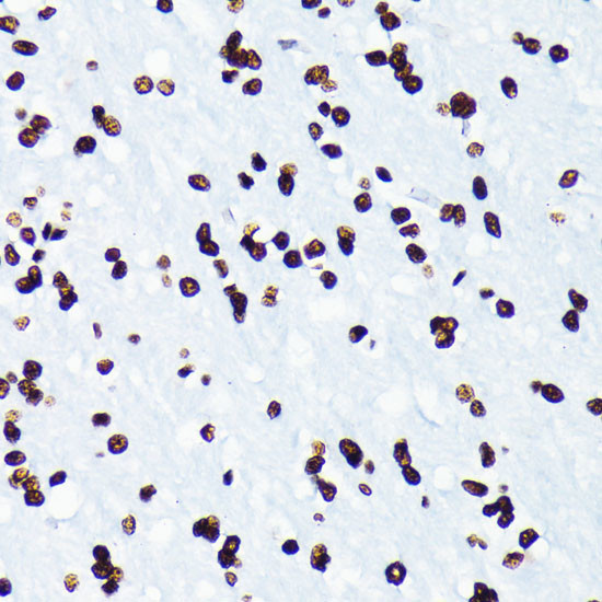 H4K5ac Antibody in Immunohistochemistry (Paraffin) (IHC (P))