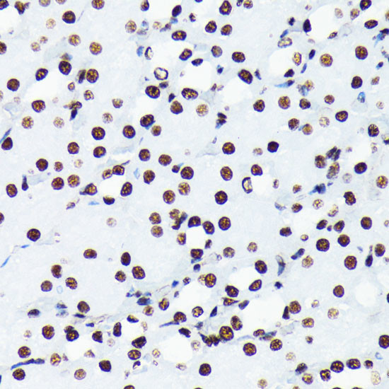 H4K5ac Antibody in Immunohistochemistry (Paraffin) (IHC (P))